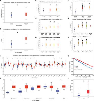 YTHDF2 Inhibits the Migration and Invasion of Lung Adenocarcinoma by Negatively Regulating the FAM83D-TGFβ1-SMAD2/3 Pathway